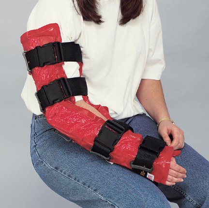 immobile-vac arm splint