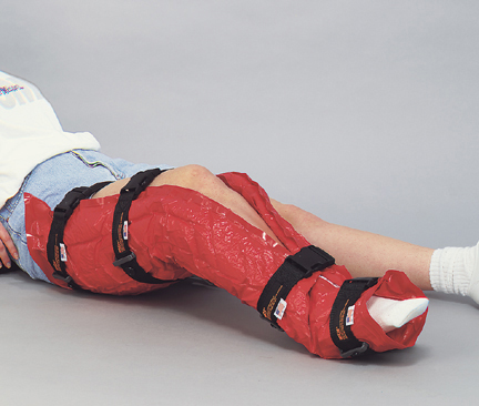 immobile vac leg splint