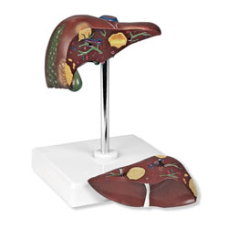 Pathological Model of the Liver