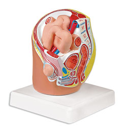 Indirect Inguinal Hernia Model