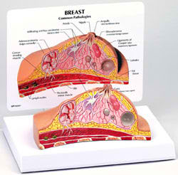 A-B-C Breast Examination Set